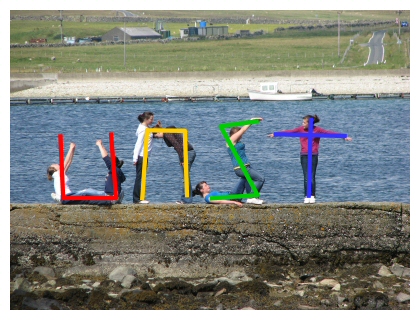 UNST